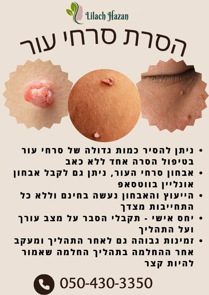 הסרת סרחי עור